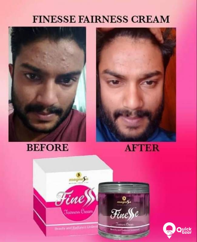 FINESSE FAIRNESS CREAM
