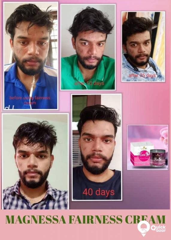 FINESSE FAIRNESS CREAM